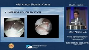 Anterior Stabilization: Achieving a Successful Bankart Repair Using These Tips