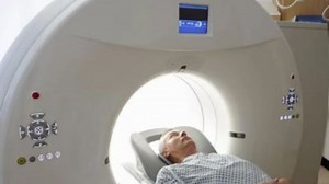 Covid surge: Can excessive CT scan lead to cancer? When to go for a CT scan? All your queries answered