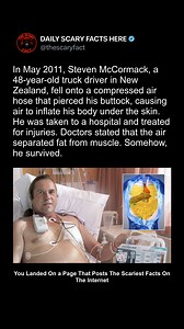 In May 2011, 48-year-old Steven McCormack experienced a freak workplace accident that sounds like something out of a cartoon. While working on a truck at a plant in New Zealand, he slipped and fell onto a compressed air hose. The metal nozzle pierced his buttock and blasted compressed air directly into his body, inflating him under the skin. Steven’s body swelled up dramatically, with air separating the layers of his skin from muscle and fat, creating a condition known as subcutaneous emphysema.