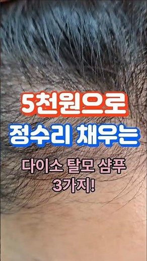 3 Daiso Hair Loss Shampoos to Fill in Your Scalp for 5,000 Won!!