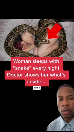 Woman sleeps with “snake” every night Doctor shows her what’s inside #fyp #truestory