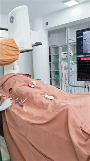 cath lab #livenursingbd