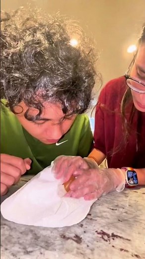 Why Doctors Sometimes Pop Blisters (When You Shouldn’t)