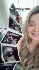 4.8K views · 18 reactions | 19 Weeks Anatomy Scan! 凉擄#19weekspregnant #pregnant #motherhood #anatomyscan | Lorelei Wilfong | Facebook