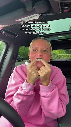 Transformation at SkinDC Dermatology Center