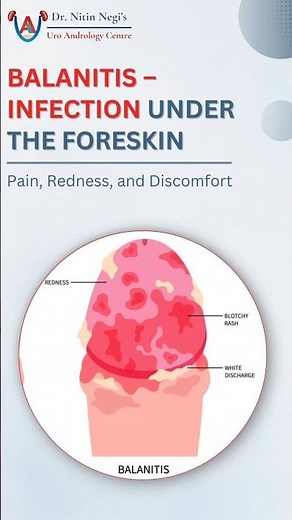 What Is Balanitis? Painful Foreskin Infection Explained | Best Urologist || Dr Nitin Negi #shorts