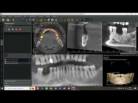 Demo QuickVision 3D software
