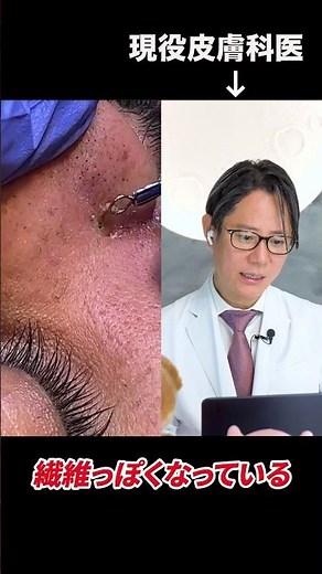 A dermatologist explains how to remove blackheads #shorts