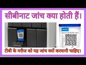 What is the CBNAAT test for TB? Why is the CBNAAT test done? How to diagnose TB with CBNAAT?