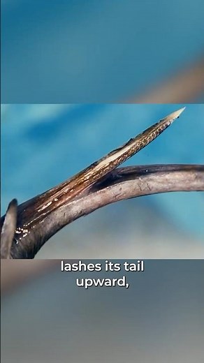 Stingray Stings are No Joke!