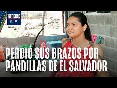 Las pandillas mataron a su madre y perdió las manos por violencia en El Salvador