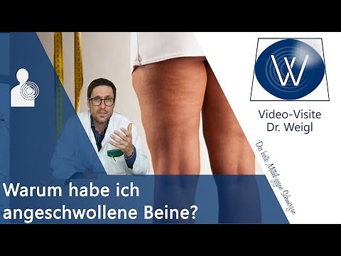 Leg edema - Swollen, thick legs: Water in the legs due to heat, heart failure, lymphedema