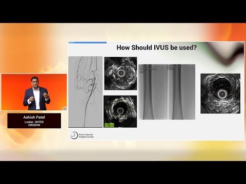 The value of IVUS in PAD procedures: a game changer - PVI 2025