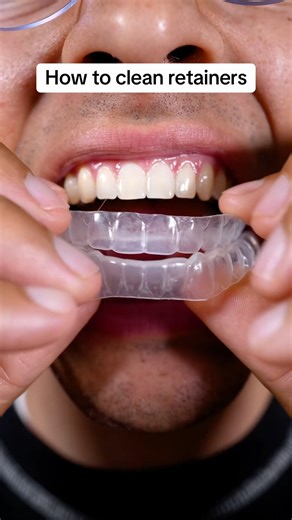 How to actually clean your retainer 😳