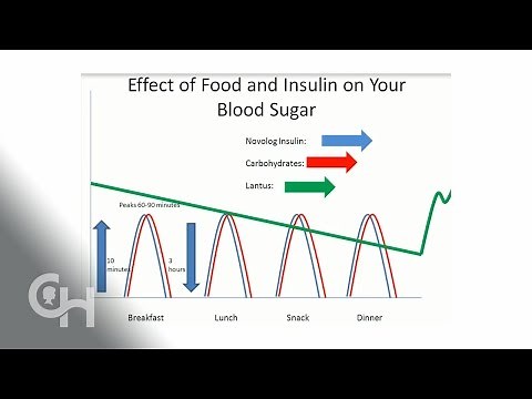 Basal/Bolus insulin and Carbohydrates