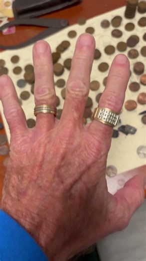 My second day on my new python hunting job I got hammered by a brown recluse spider