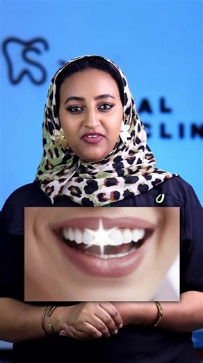 holywood smile 😊 #samdentalclinic #dentalclinicnearsummit #bestdentalinaddisababa #ethiopiantiktok🇪🇹🇪🇹🇪🇹🇪🇹