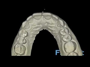 A Closer Look at the FirstFit Software