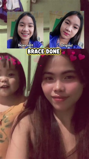 Brace Done: Share and React to the Fun!