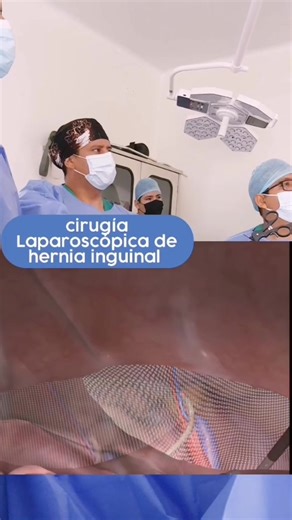 Cirugía de Hernia Inguinal Laparoscópica: Todo lo Que Debes Saber