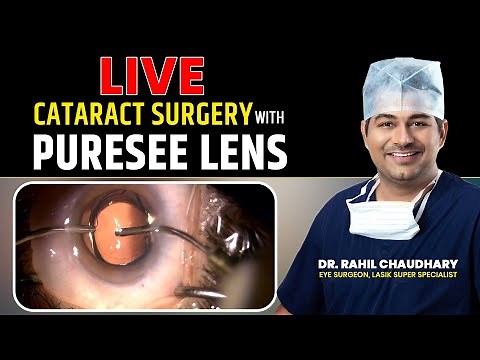 Live Cataract Surgery With Puresee Lens (IOL) at Delhi Ophthalmic conference (DOS) by Dr. Rahil