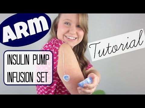 ARM Insulin Pump Infusion Set Tutorial!