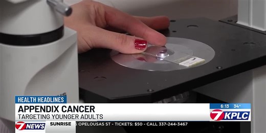 New study shows increase in appendix cancer in younger generations