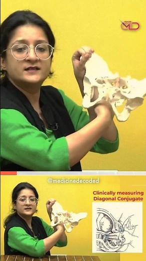 Measuring the Diagonal Conjugate ‪@medicinedecoded.‬ #diagonalconjugate