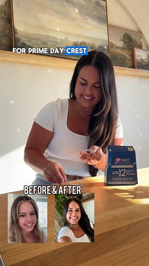 Save Up to 40% Off Crest 3D Whitestrips Professional Effects on Amazon Prime Day!