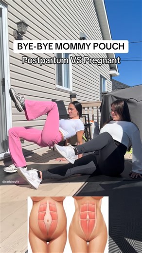 Carla Krikorian | IFBB PRO Pregnancy & Postpartum Coach on Instagram: "Prevent during pregnancy. Heal after baby. With one of my mamas, I’m showing how breathing + deep core work protects your body while pregnant and helps your belly recover postpartum. This isn’t about bouncing back. It’s about training your body the right way at every stage. Pregnancy is where prevention starts. Postpartum is where healing happens. Both deserve the right approach. 👉 Do you want more videos like this, or shoul