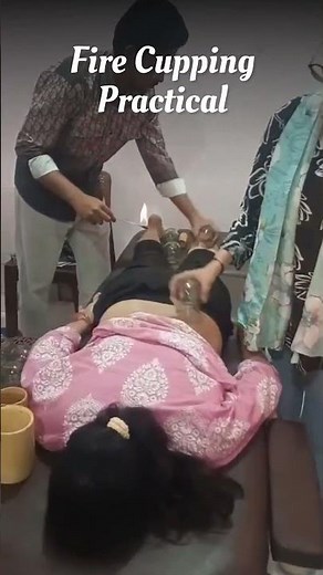 Traditional fire cupping technique you need to see #cupping #massage #asmr