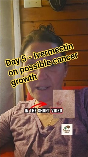 Day 5 - Ivermectin on possible cancer growth