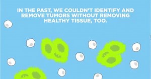 One of the biggest challenges of #cancer surgery is making sure no stray cells are left behind. But with MSK’s pioneering research in #nanotechnology, cancer is running out of places to hide. #morescience #changecancer | Memorial Sloan Kettering Cancer Center