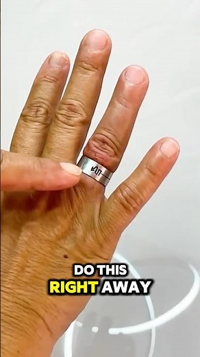 How to Get a Stuck Ring Off Your Finger (EASY METHODS) #stuckring