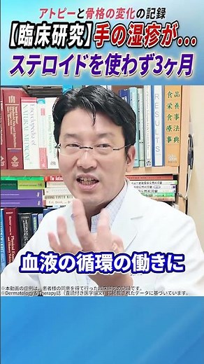 Eczema on the hands... 3 months without using steroids. A record of atopic dermatitis and skeleta...