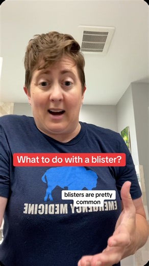 212K views · 18K reactions | Blisters are common and can be managed different ways. I usually leave them intact to give the tissue time to heal #blister #emergency #wound #doctor #feet Disclaimer: For educational and entertainment purposes only and should not be regarded as medical advice or replace the advice of your physician | Dr.Beachgem10 | Facebook