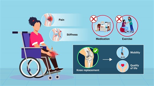 "Psychometric Properties and Feasibility of PROMIS Computerized Adaptive Tests Compared with Disease-Specific Measures in Knee Arthroplasty" by Dhollander et al. Read the full article - https://bit.ly/4osTu3W #knee | The Journal of Bone & Joint Surgery (JBJS)