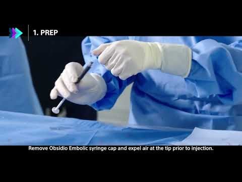 Obsidio™ Conformable Embolic deployment in three steps