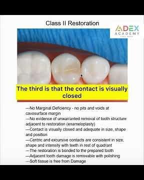 Class II Restoration Requirements for ADEX