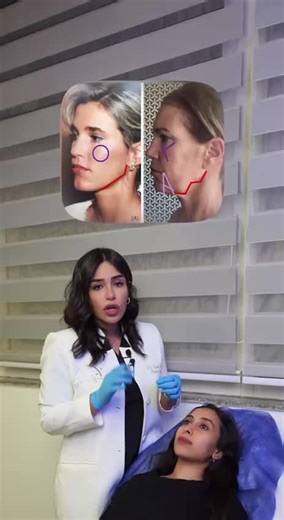 Dr. Dena explains the importance of targeted injection points when enhancing the cheek area. #plasticsurgeon #plasticsurgery #cosmeticsurgery #liposuction #beauty #surgery #tummytuck #breastptosis #Fractionallaser #breastaugmentation #breastimplants #confident #women #sexier #diastasisrecti #postpartum #pelvicfloor #diastasisrectirepair #postpartumfitness #postpartumbody #diastasis #postnatal #pregnancy #filler #cheekfiller