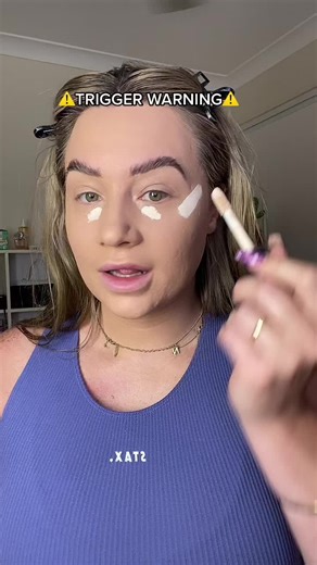 My Eating Disorder Recovery Journey: Part 3