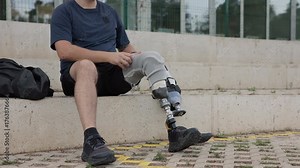 Sitting on the steps, a man taking off his prosthetic leg and dressing an orthopedic equipment for fitness and sport training, a running blade, close up shot.