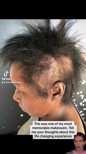 Alopecia Transformation: Confidence and Self-Love Journey