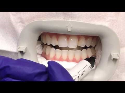 How does Whitespeed Zoom! Teeth Whitening work?