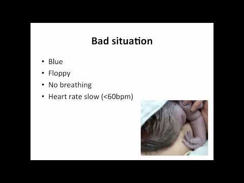 Paediatrics - neonatal resuscitation