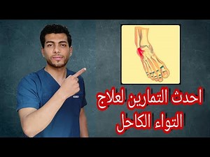 علاج التواء الكاحل|احدث التمارين لعلاج التواء الكاحل وتورمه