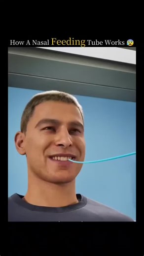 Universal Facts ♾️ on Instagram: "How a nasal feeding tube works 😰. #🇯🇵 日本では、人々の足跡が電気に変わる！⚡ 圧電タイルを使って、一歩ごとに小さなエネルギーを生み出します。 何百万人もの人々の歩みが集まると、渋谷駅のような場所でLEDライトやディスプレイを動かすことができます。 動きをクリーンで再生可能なエネルギーに変える——持続可能でスマートな都市づくりの素晴らしいアイデアです🌱💡 #日本のイノベーション #圧電 未来技術 グリーンエネルギー 再生可能エネルギー クリーンエネルギー 持続可能な未来 スマートシティ テクノロジーの力 エコ技術 都市エネルギー 東京ライフ 渋谷駅 イノベーション モダンジャパン エコフレンドリー スマートテクノロジー エネルギー革命 テックニュース サステナブルライフ🇯🇵 日本では、人々の足跡が電気に変わる！⚡ 圧電タイルを使って、一歩ごとに小さなエネルギーを生み出します。 何百万人もの人々の歩みが集まると、渋谷駅のような場所でLEDライトやディスプレイを動かすことが