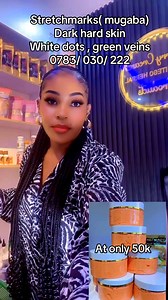 Any problem with yo skincare , body shaping, bedroom secrets , kyogo and stretch marks pls call me or watsup on 0783030222 watsup | Sherry Matovu | Facebook