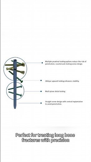 Intramedullary Nail — Precision for Fracture Fixation 🦴