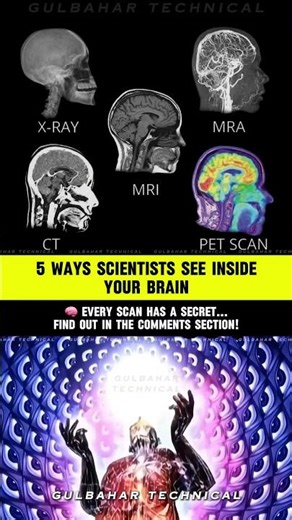 5 Ways Scientists Look Inside Your Brain | The Truth About MRI, CT, and PET Scans 😱📡